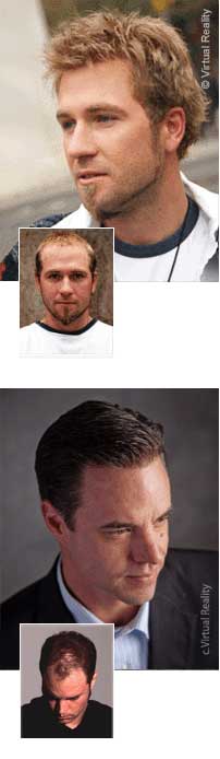Men S Hair Replacement Systems North Shore Wigs Hair